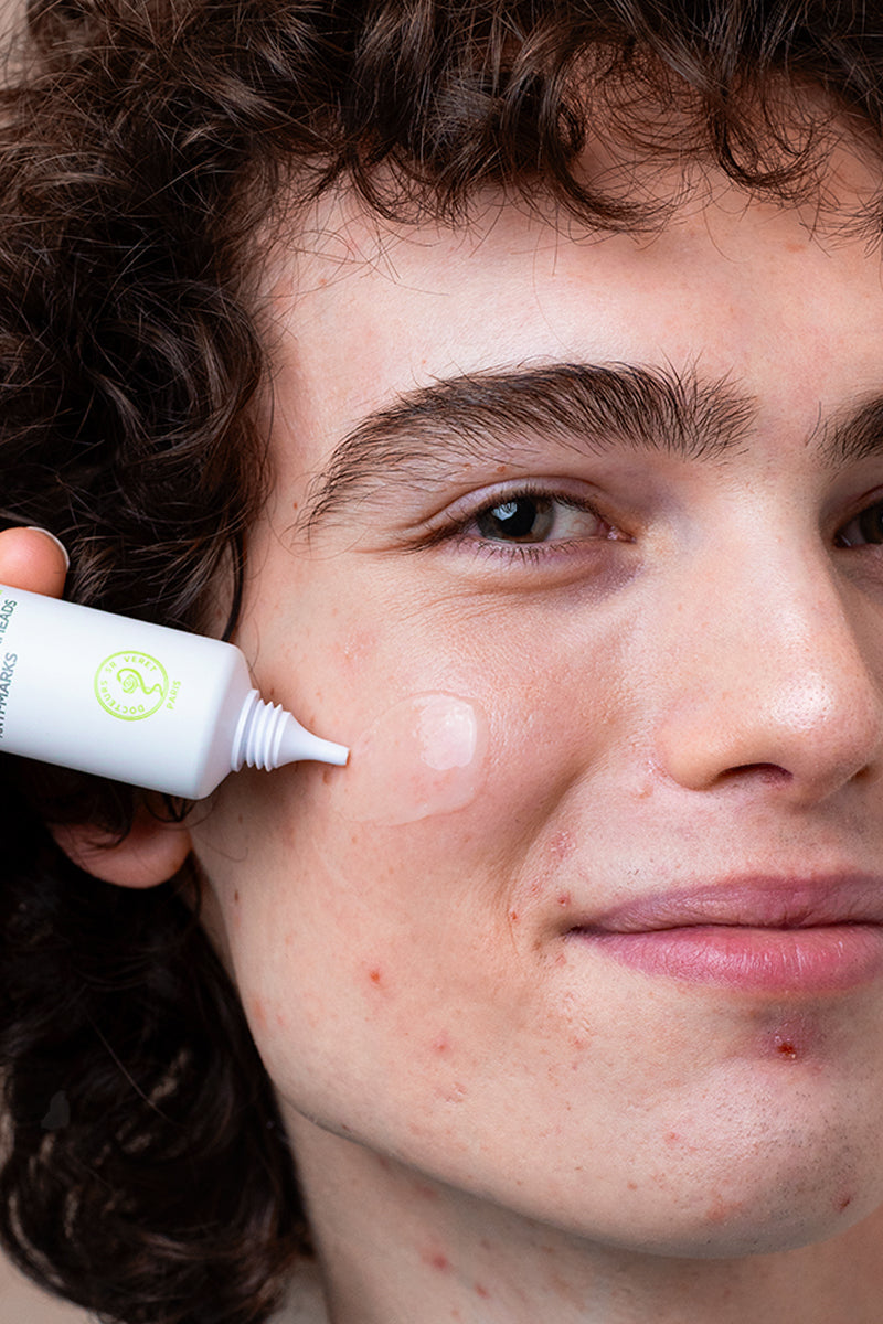 Acne: how to improve it