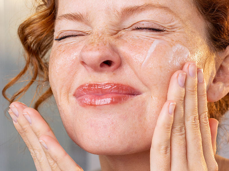 Woman with freckles and curly red hair gently applying a soothing cream to her sensitive skin.