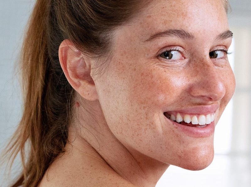 Smiling woman with freckles and a glowing, hydrated complexion looking over her shoulder.