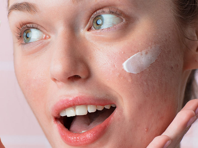 Young woman with acne-prone skin applying a white cream treatment to her cheek against a pink background.