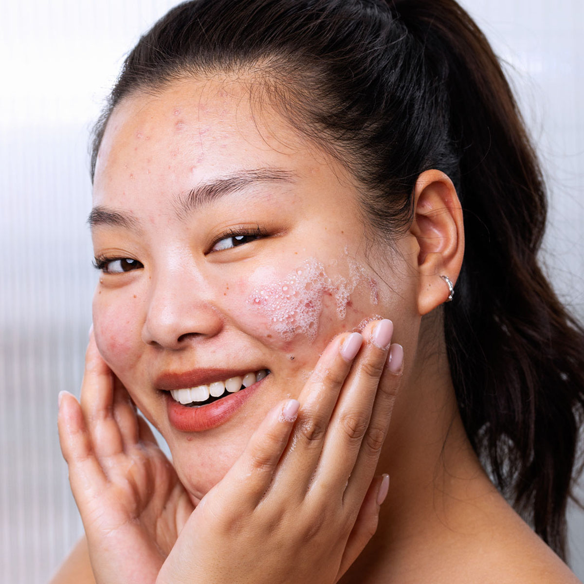 Smiling woman with acne-prone skin applying white SEBIACLEAR foaming gel cleanser to her face.