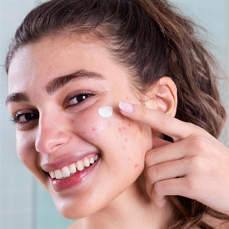 SVR Sebiaclear Range – Gentle Acne Skincare Solutions
