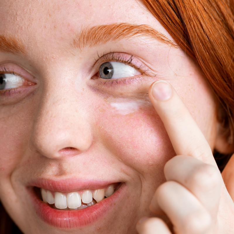Close-up of a smiling red-haired woman applying white cream under her eye on fair skin.